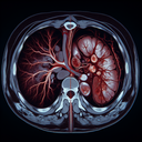 МРТ селезінки